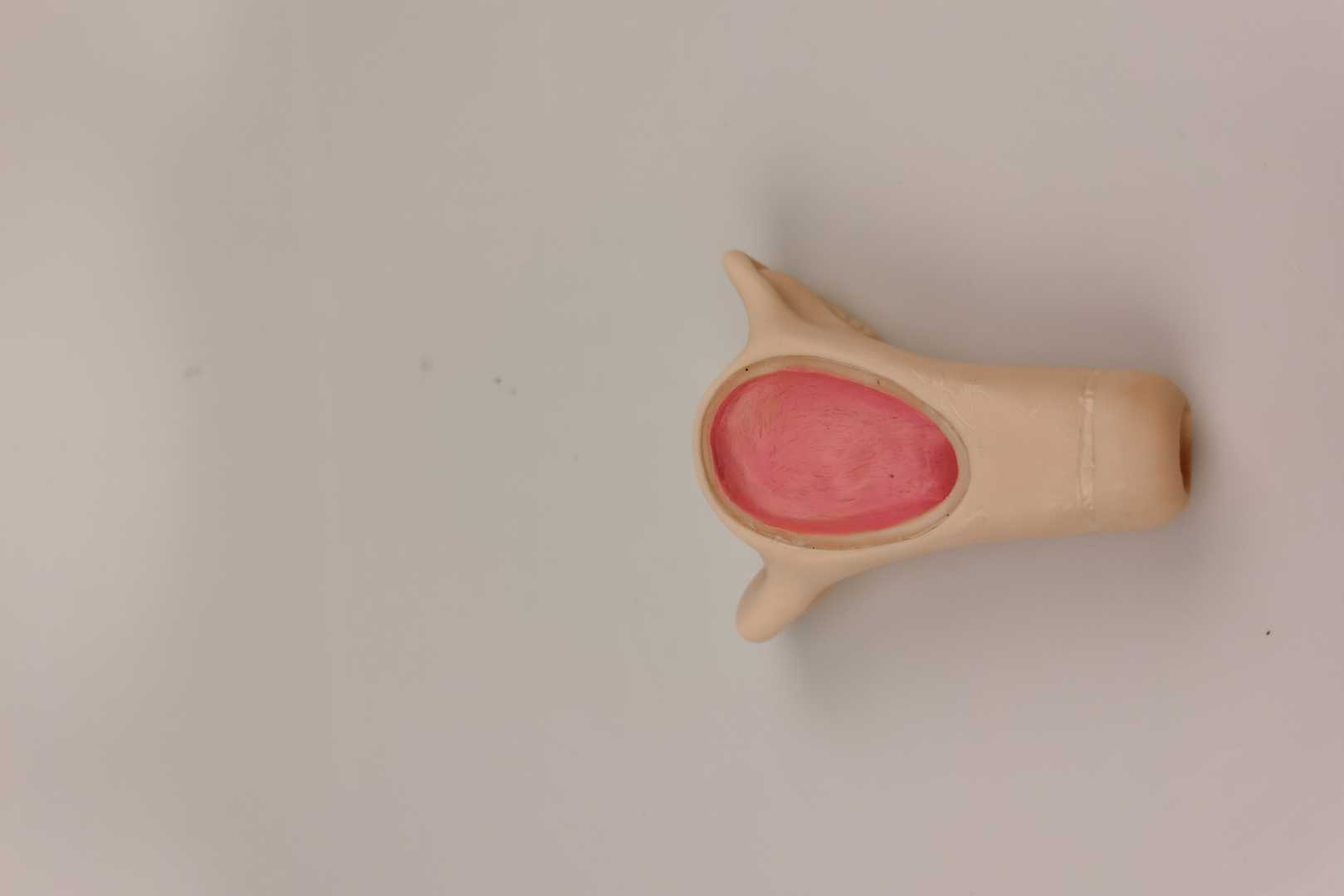 IUD Insertion Model II