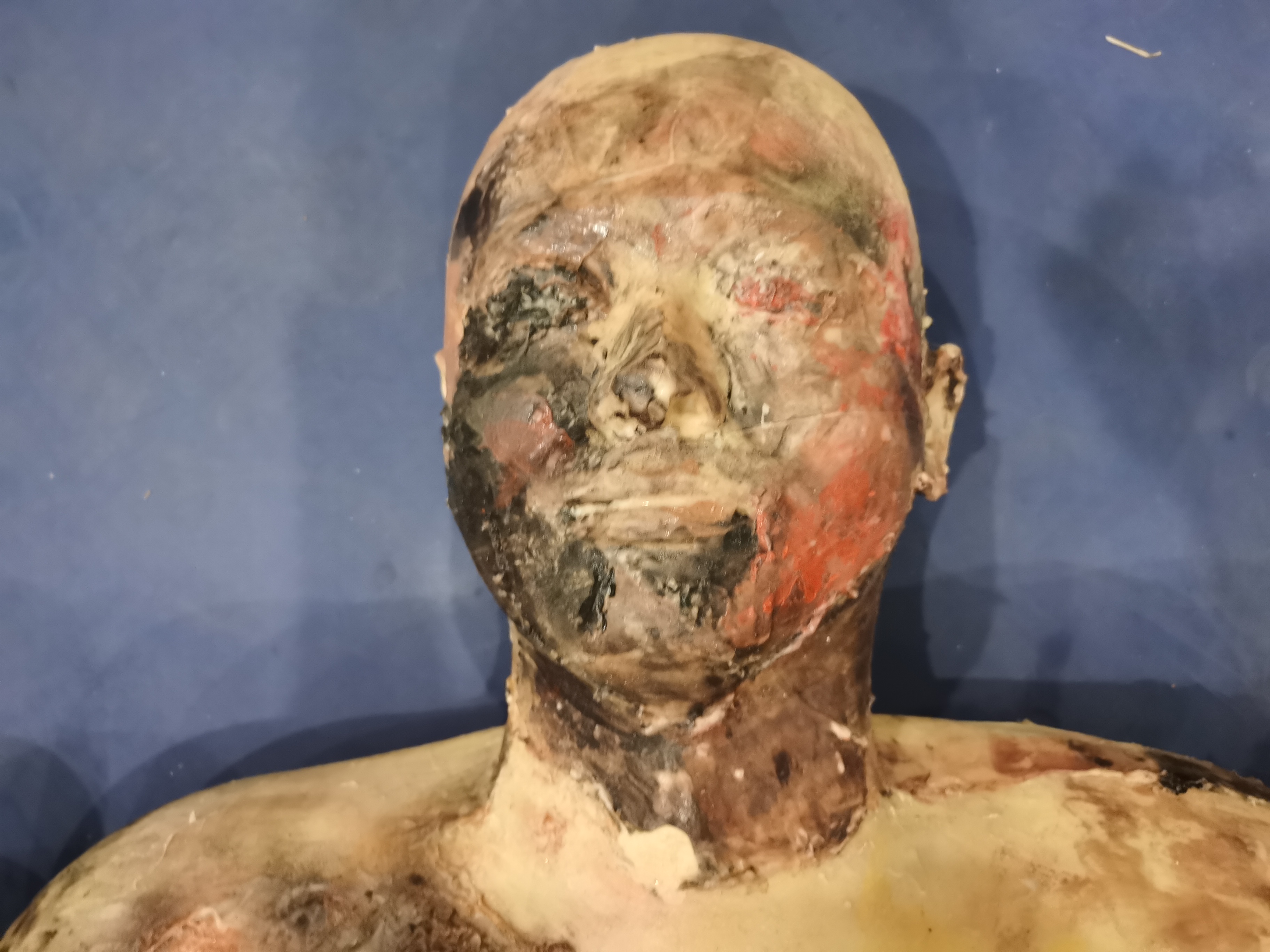 Full-body Burn Assessment Manikin